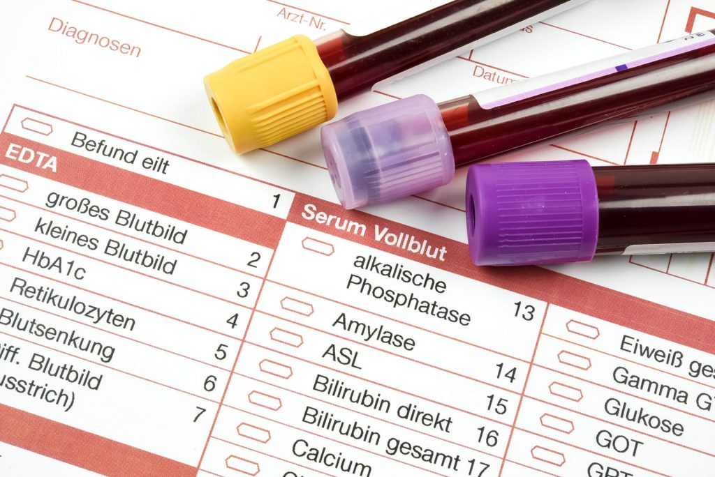 Labordiagnostik